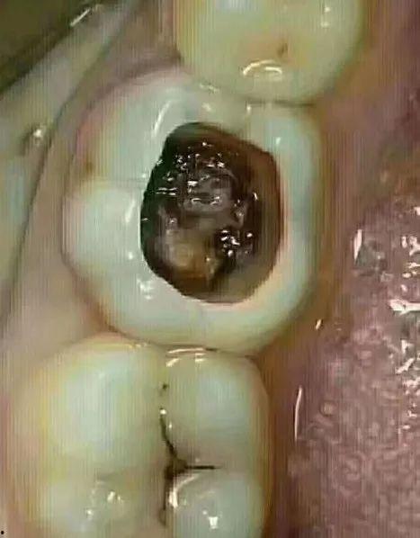 假牙吃瓜,一场关于假牙与瓜果的趣味之旅